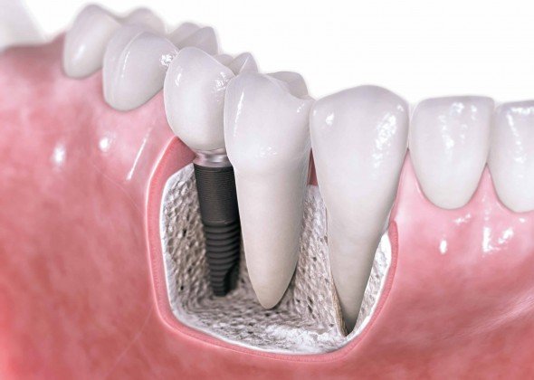 Dentalll - Clinica stomatologica